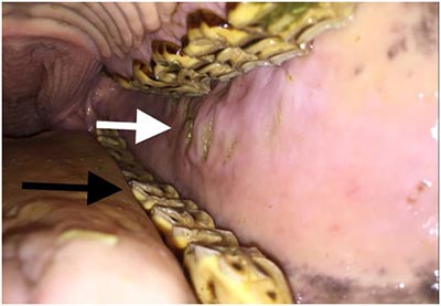 Equine Dentistry Equine Dentistry