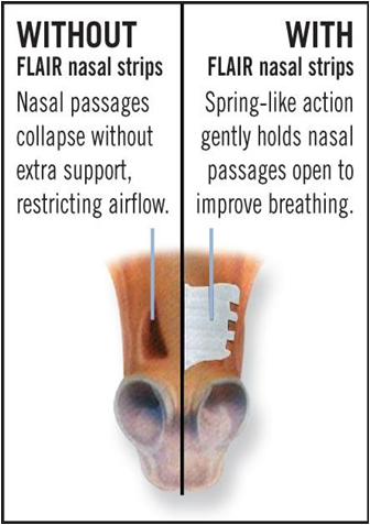 FLAIR® Equine Nasal Strips - With and Without FLAIR® Equine Nasal Strips - With and Without
