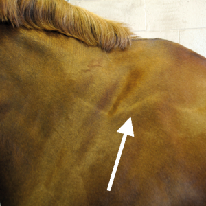 Stress Lines – an incorrectly fitted gullet plate putting constant pressure on the side of the withers can result in the formation of a stress line as well as a constant contraction of the trapezius. Stress Lines – an incorrectly fitted gullet plate putting constant pressure on the side of the withers can result in the formation of a stress line as well as a constant contraction of the trapezius.