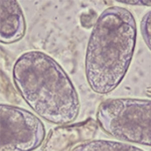 Strongyle eggs seen under microscope, from fecal sample. Strongyle eggs seen under microscope, from fecal sample.